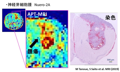 マウス脳腫瘍　APT-CESTイメージング