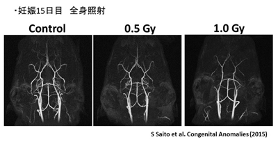 胎生期放射線曝露モデル　脳血管