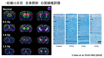 胎生期放射線曝露モデル　脳白質繊維